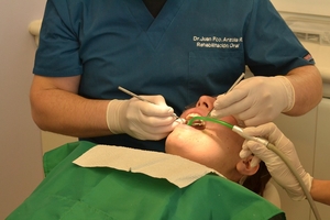 Нашият каталог с Dental Implants 9