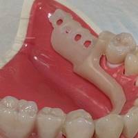 Намерете най-добрите оферти за естетична стоматология 33 от MedicalDent Намерете най-добрите оферти за естетична стоматология 33