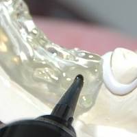 Вижте каталога ни с естетична стоматология 4 от MedicalDent Вижте каталога ни с естетична стоматология 4