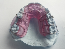 Оферти за избелване на зъби 38