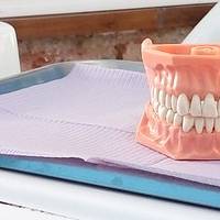Видове пародонтологична профилактика 13 от MedicalDent Видове пародонтологична профилактика 13
