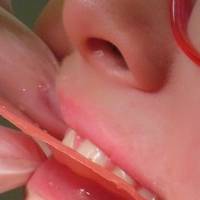 Голямо разнообразие порцеланови коронки 40 от MedicalDent Голямо разнообразие порцеланови коронки 40