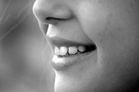 Информация за поставяне на фасети 6 от The Smile Company Информация за поставяне на фасети 6