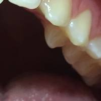 Каталог възпалени венци 31 от MedicalDent Каталог възпалени венци 31