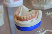 Изберете нашите  Зъбни импланти 29