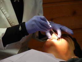 Най-добрите на пазара зъбни импланти цени 16