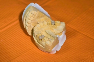 Намерете Invisalign 33 - DsDent Намерете Invisalign 33