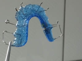 Повече за Invisalign 35 - DsDent Повече за Invisalign 35