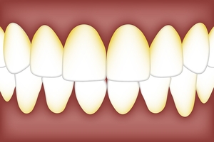 Вижте каталога ни с Invisalign 36 - DsDent Вижте каталога ни с Invisalign 36