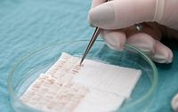 зъбни импланти - 58123 възможности зъбни импланти - 62899 възможности