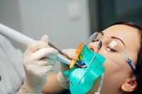 избелване на зъби - 98118 клиенти