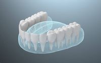 избелващи ленти за зъби - 14061 варианти | Dentalcare избелващи ленти за зъби - 83750 варианти