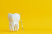 избелване на зъби в домашни условия - 81918 селекции | Dentalcare избелване на зъби в домашни условия - 95414 селекции