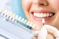 избелване на зъби в домашни условия - 52258 цени | Dentalcare избелване на зъби в домашни условия - 51869 цени