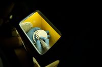 зъбни импланти - 42662 възможности | Deckoff Dental зъбни импланти - 86820 възможности