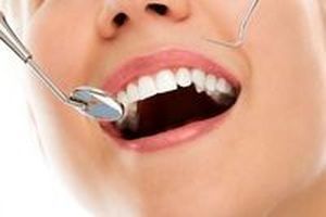 бондинг на зъби - 68730 селекции | Supreme Dental бондинг на зъби - 82189 селекции