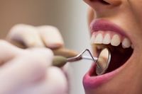 изтрити зъби - 25946 възможности изтрити зъби - 63923 възможности